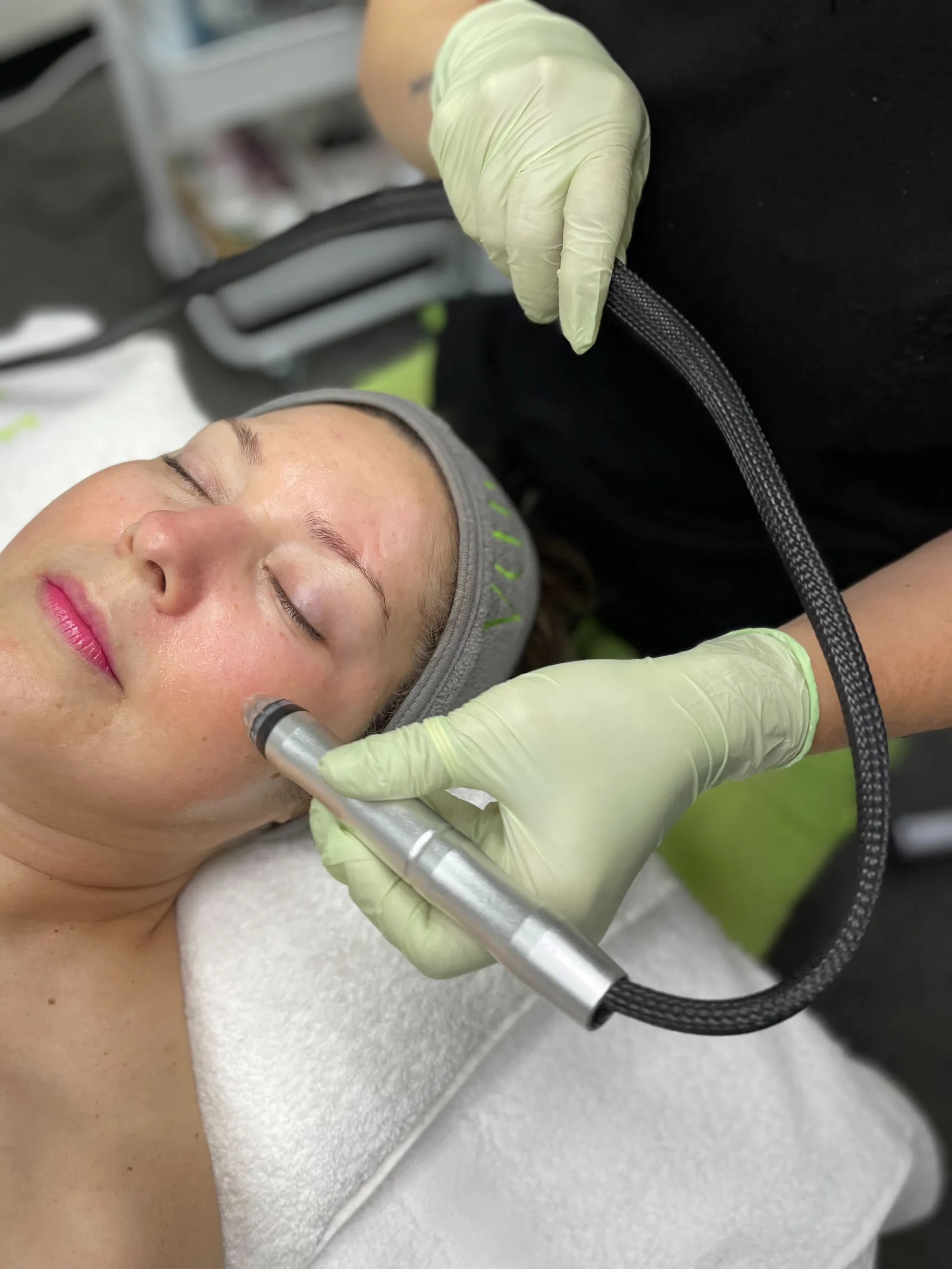 HydraFacial professional treatment