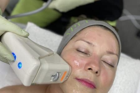 HIFU Facial vs. Traditional Facelifts: A Non-Invasive Alternative